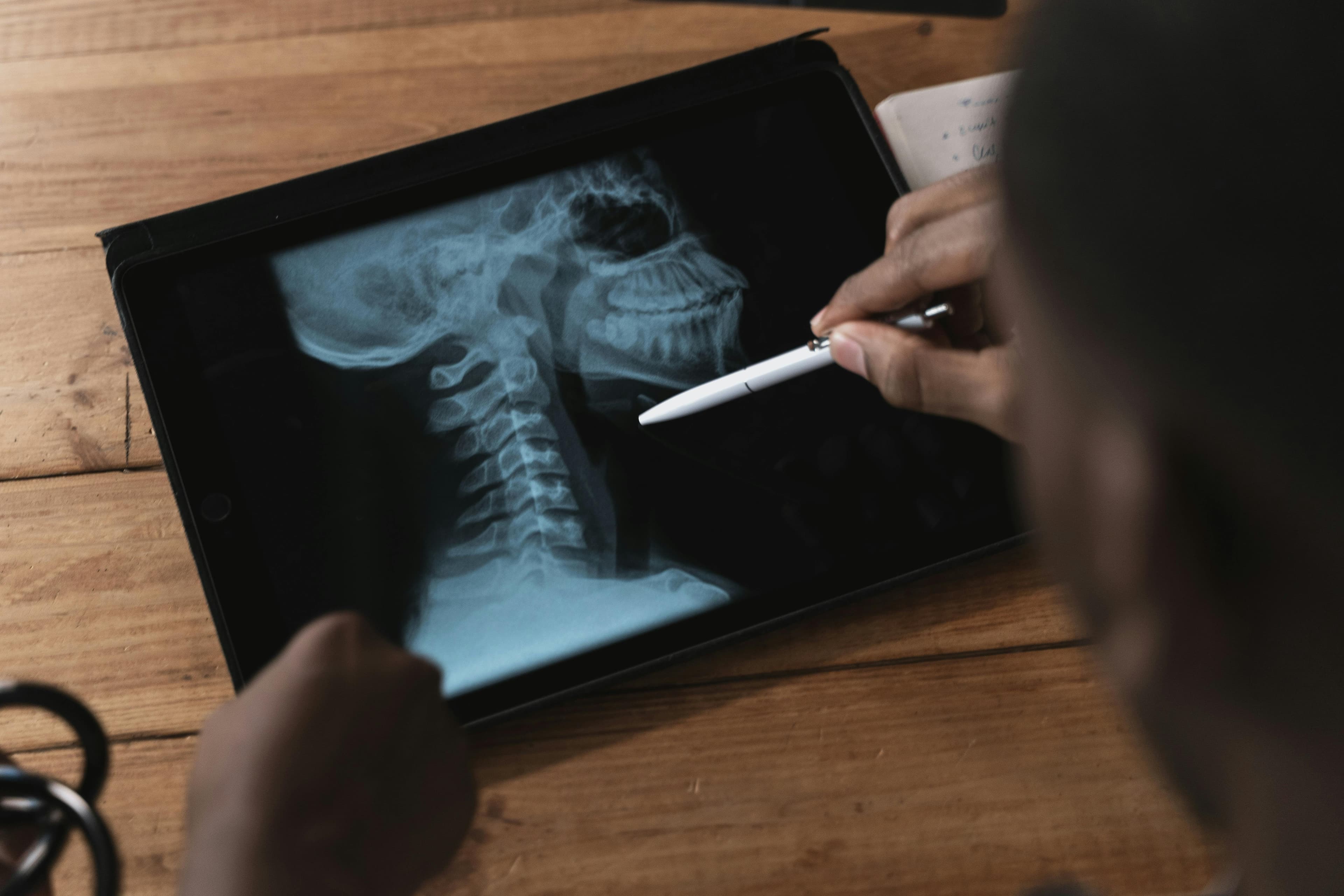 A spine surgeon consulting with a patient, reviewing MRI scans on a computer screen