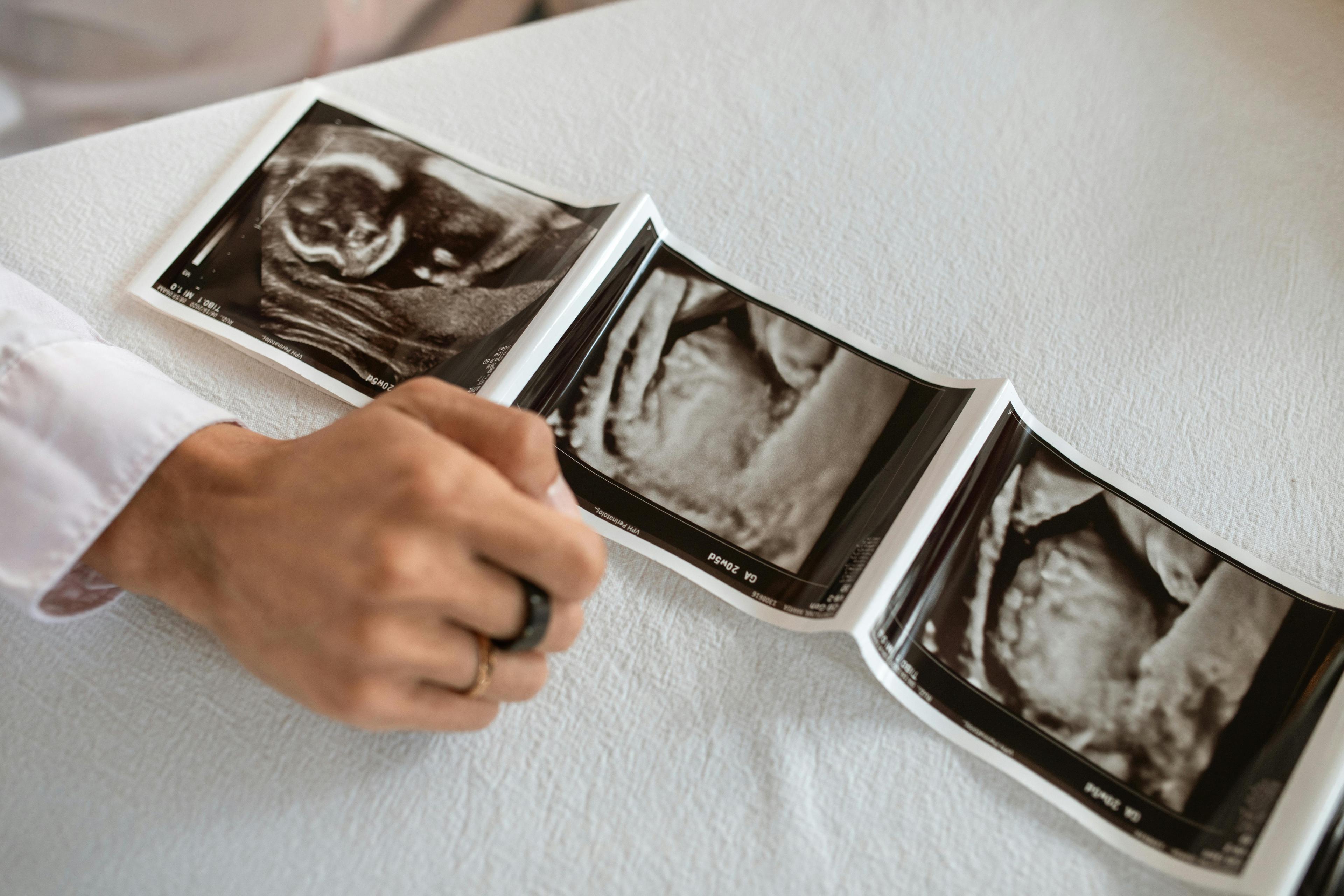 Expectant parents viewing a 3D ultrasound image with a healthcare provider