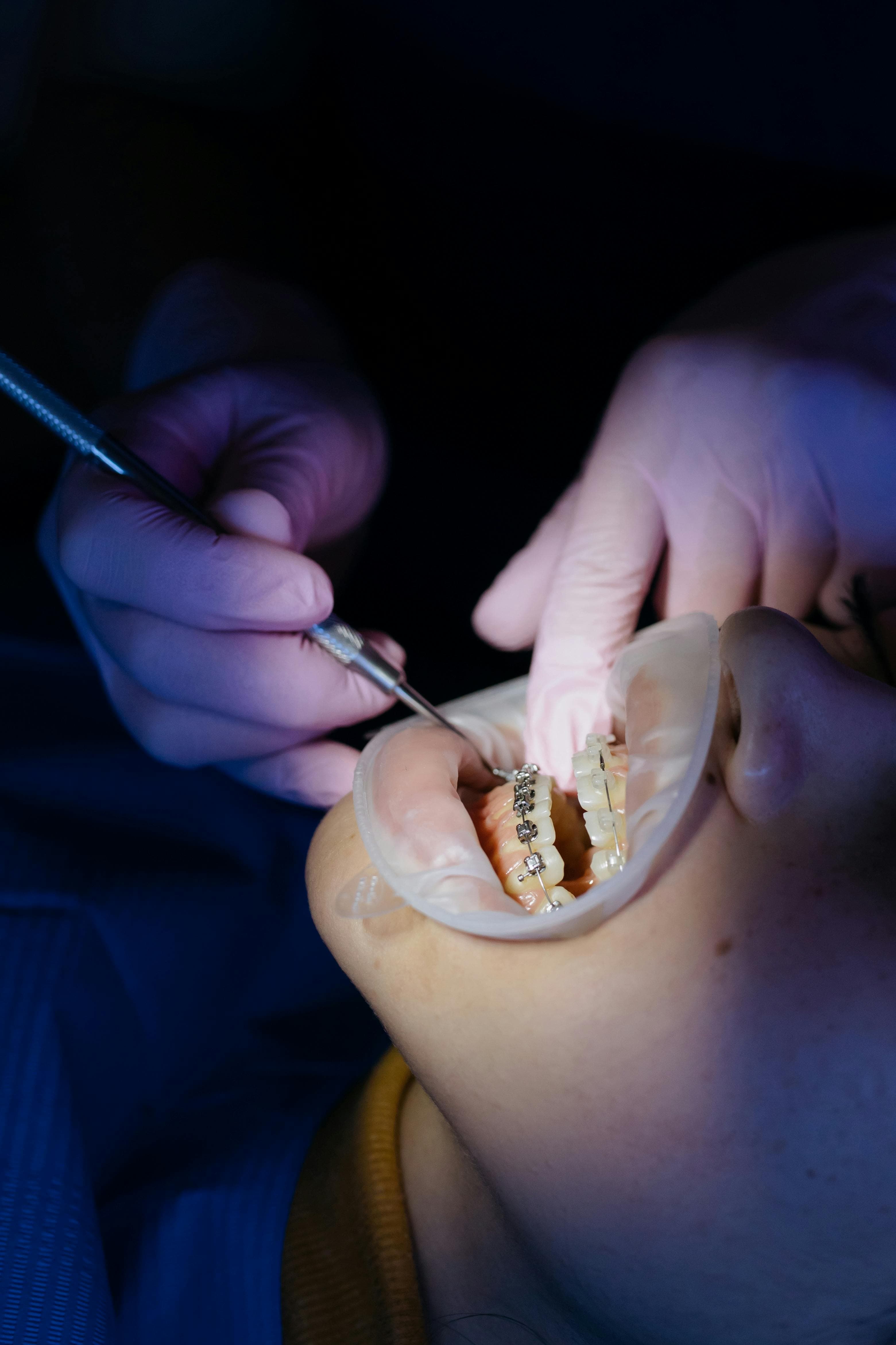 Doctor examining a patient's jaw for muscle spasms